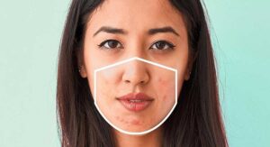 5 Tips to Prevent and Treat Maskne