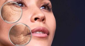 Qu’est-ce que la glycation et comment affecte-t-elle votre peau ?